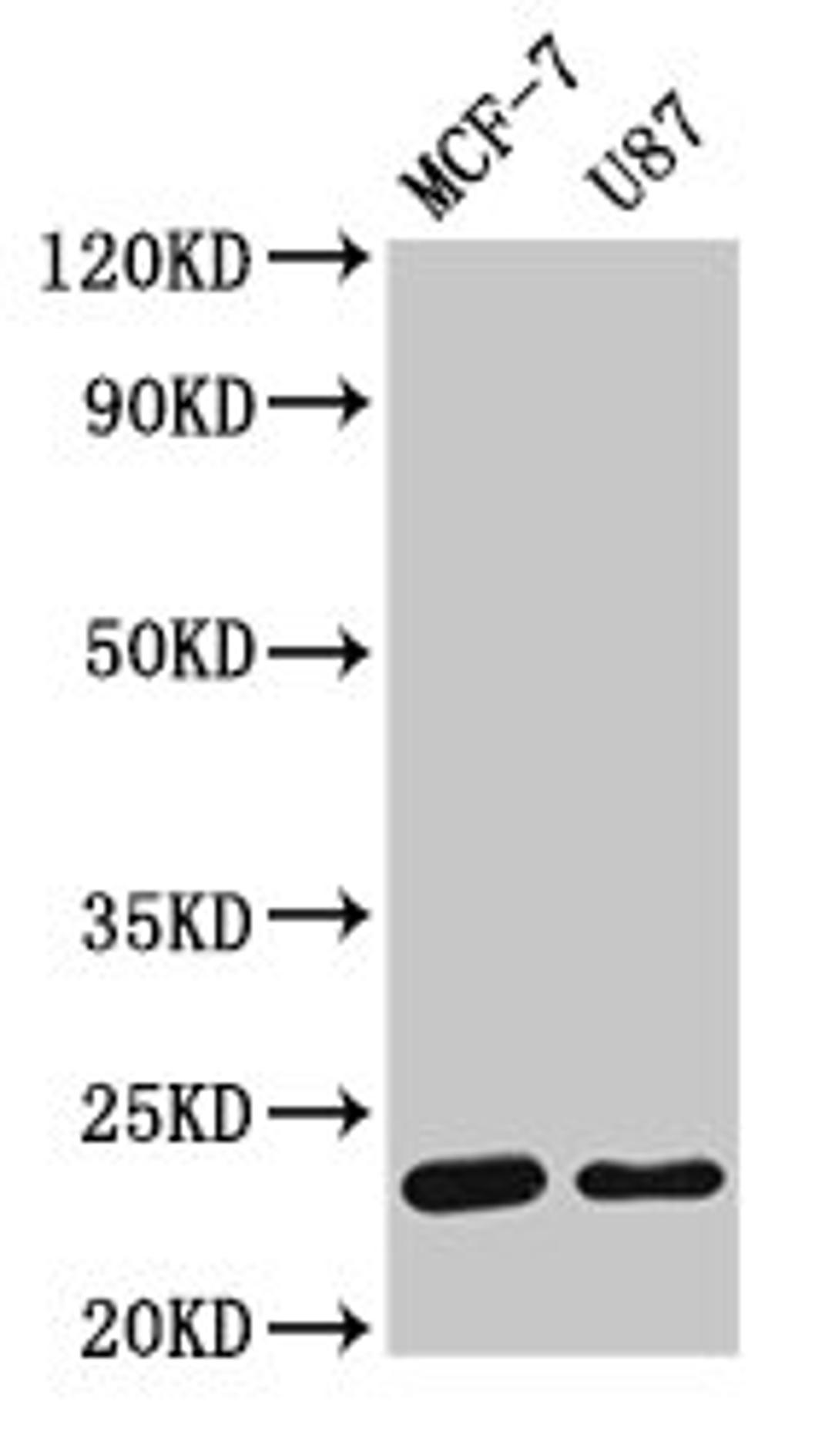Western Blot. Positive WB detected in: MCF-7 whole cell lysate, U87 whole cell lysate. All lanes: HIST1H1B antibody at 1.5µg/ml. Secondary. Goat polyclonal to rabbit IgG at 1/50000 dilution. Predicted band size: 23 kDa. Observed band size: 23 kDa