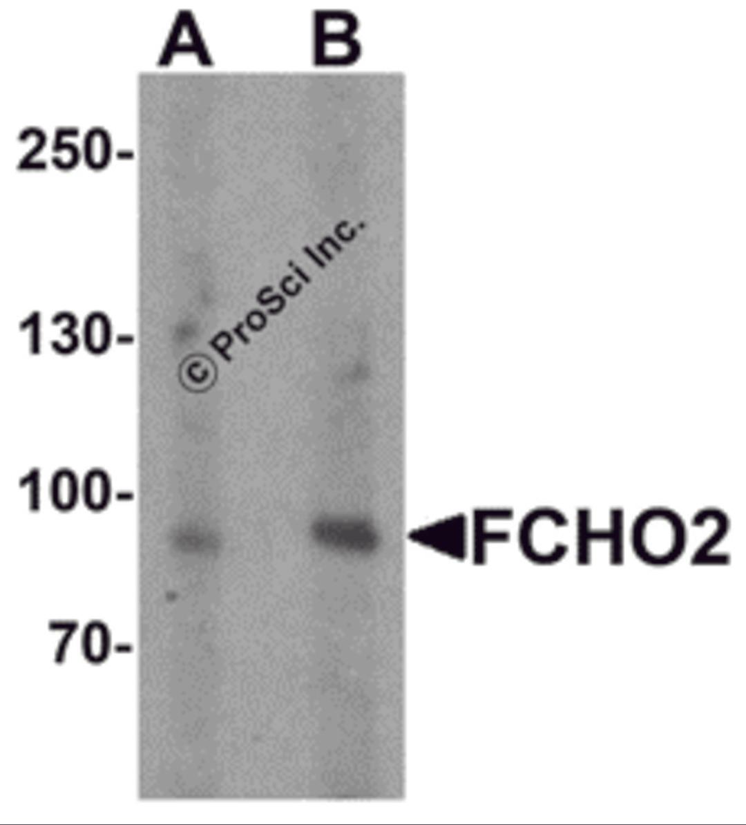 Western blot analysis of FCHO2 in rat heart tissue lysate with FCHO2 antibody at (A) 1 and (B) 2 &#956;g/ml