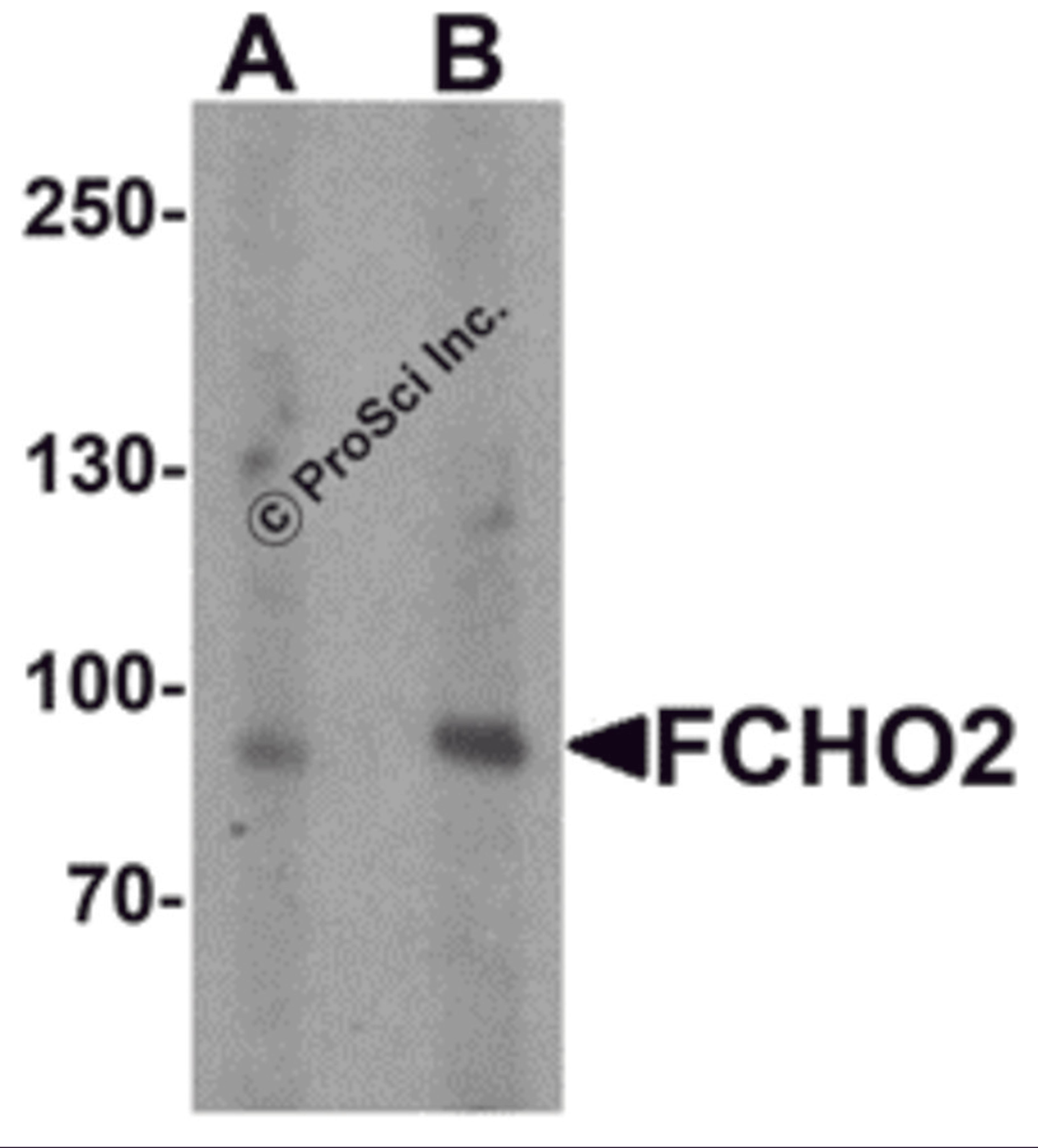 Western blot analysis of FCHO2 in rat heart tissue lysate with FCHO2 antibody at (A) 1 and (B) 2 &#956;g/ml