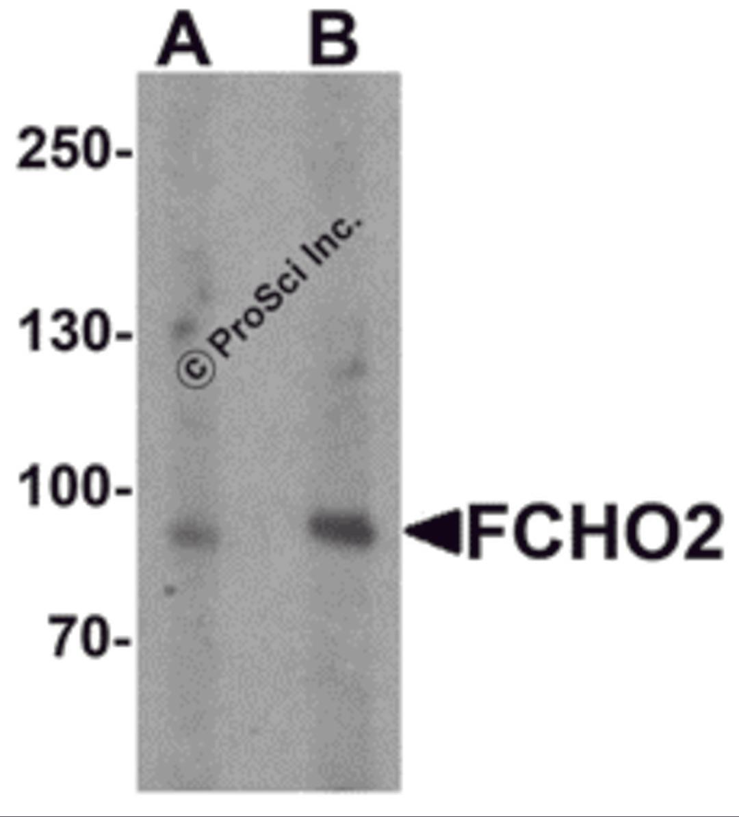 Western blot analysis of FCHO2 in rat heart tissue lysate with FCHO2 antibody at (A) 1 and (B) 2 μg/ml