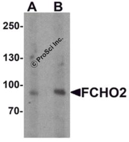Western blot analysis of FCHO2 in rat heart tissue lysate with FCHO2 antibody at (A) 1 and (B) 2 μg/ml