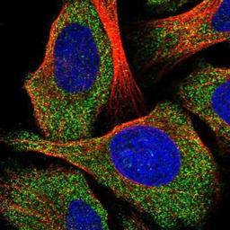 Immunocytochemistry/Immunofluorescence: SLC39A13 Antibody [NBP1-92404] - Staining of human cell line U-2 OS shows positivity in cytoplasm.