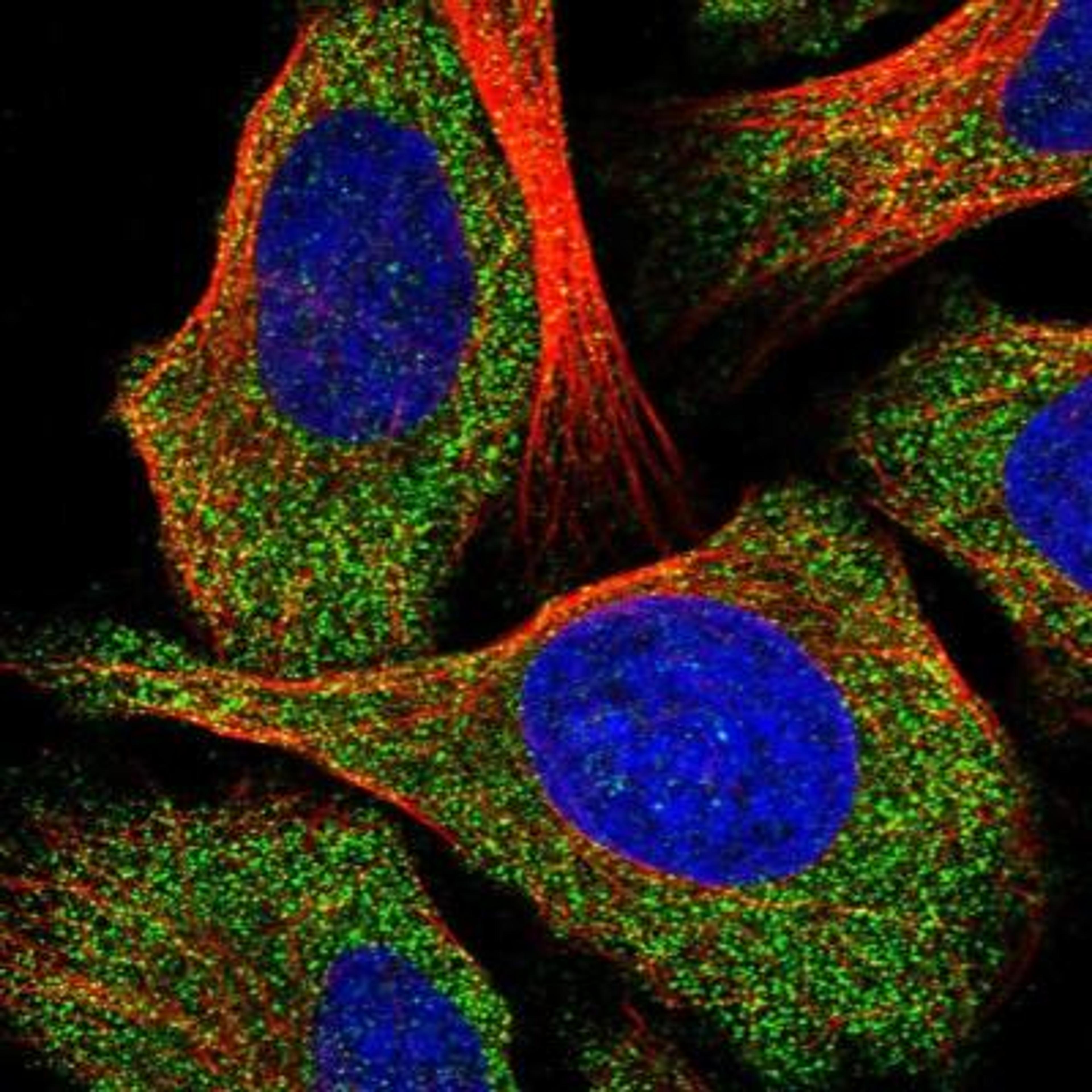 Immunocytochemistry/Immunofluorescence: SLC39A13 Antibody [NBP1-92404] - Staining of human cell line U-2 OS shows positivity in cytoplasm.