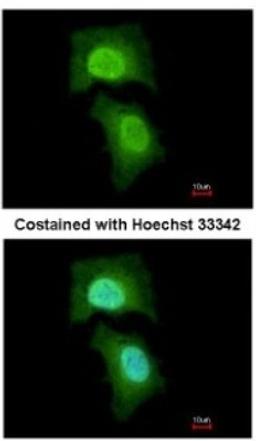 Immunocytochemistry/Immunofluorescence: MPHOSPH6 Antibody [NBP2-19388] - Analysis of paraformaldehyde-fixed HeLa, using antibody at 1:200 dilution.