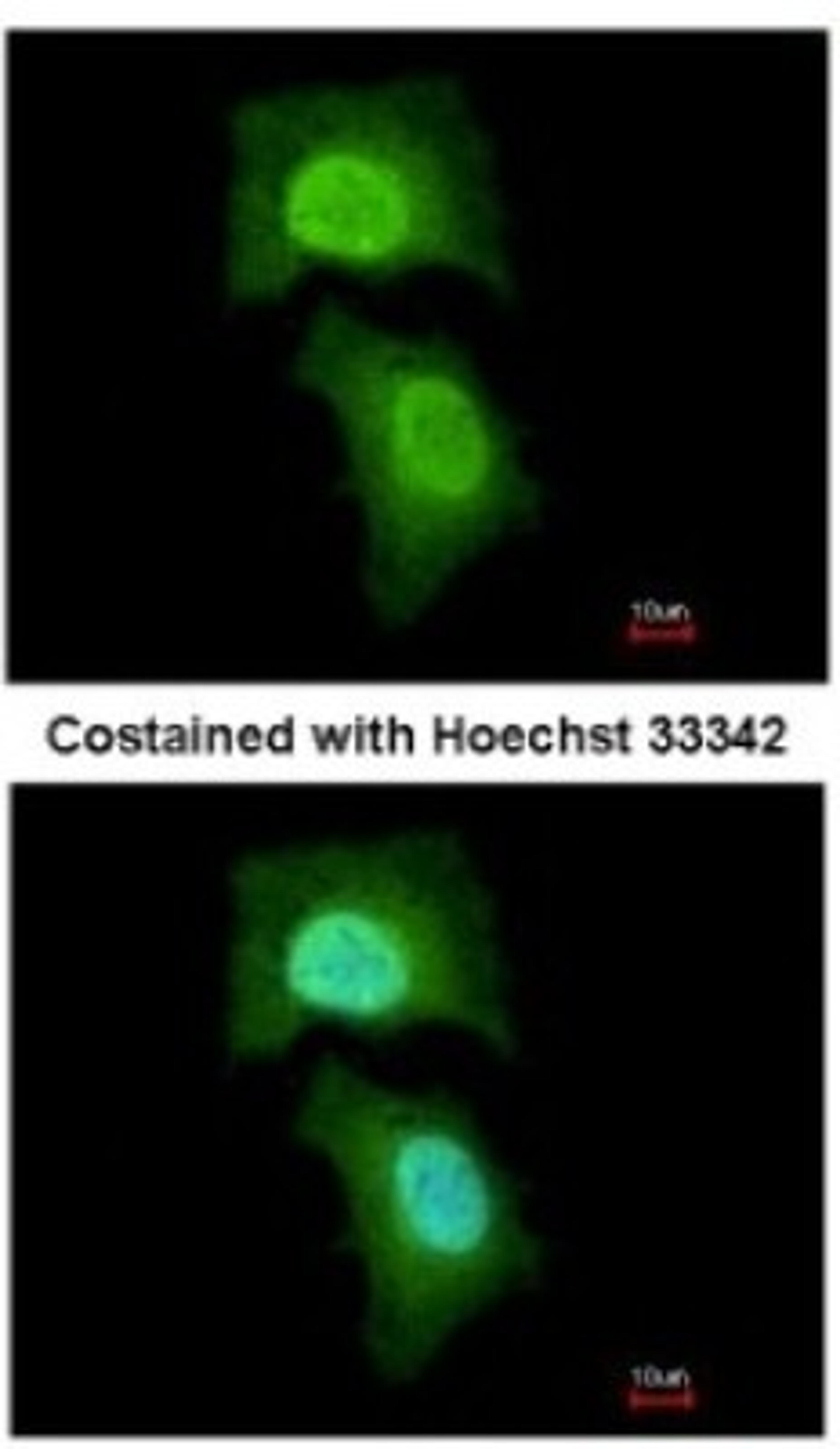 Immunocytochemistry/Immunofluorescence: MPHOSPH6 Antibody [NBP2-19388] - Analysis of paraformaldehyde-fixed HeLa, using antibody at 1:200 dilution.