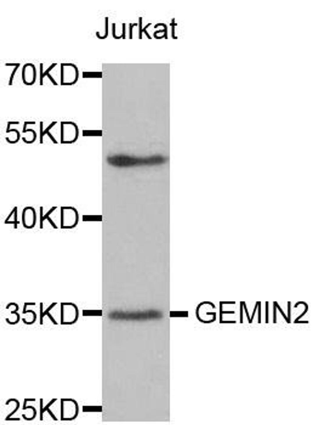 Western blot analysis of extracts of Jurkat cell line using GEMIN2 antibody