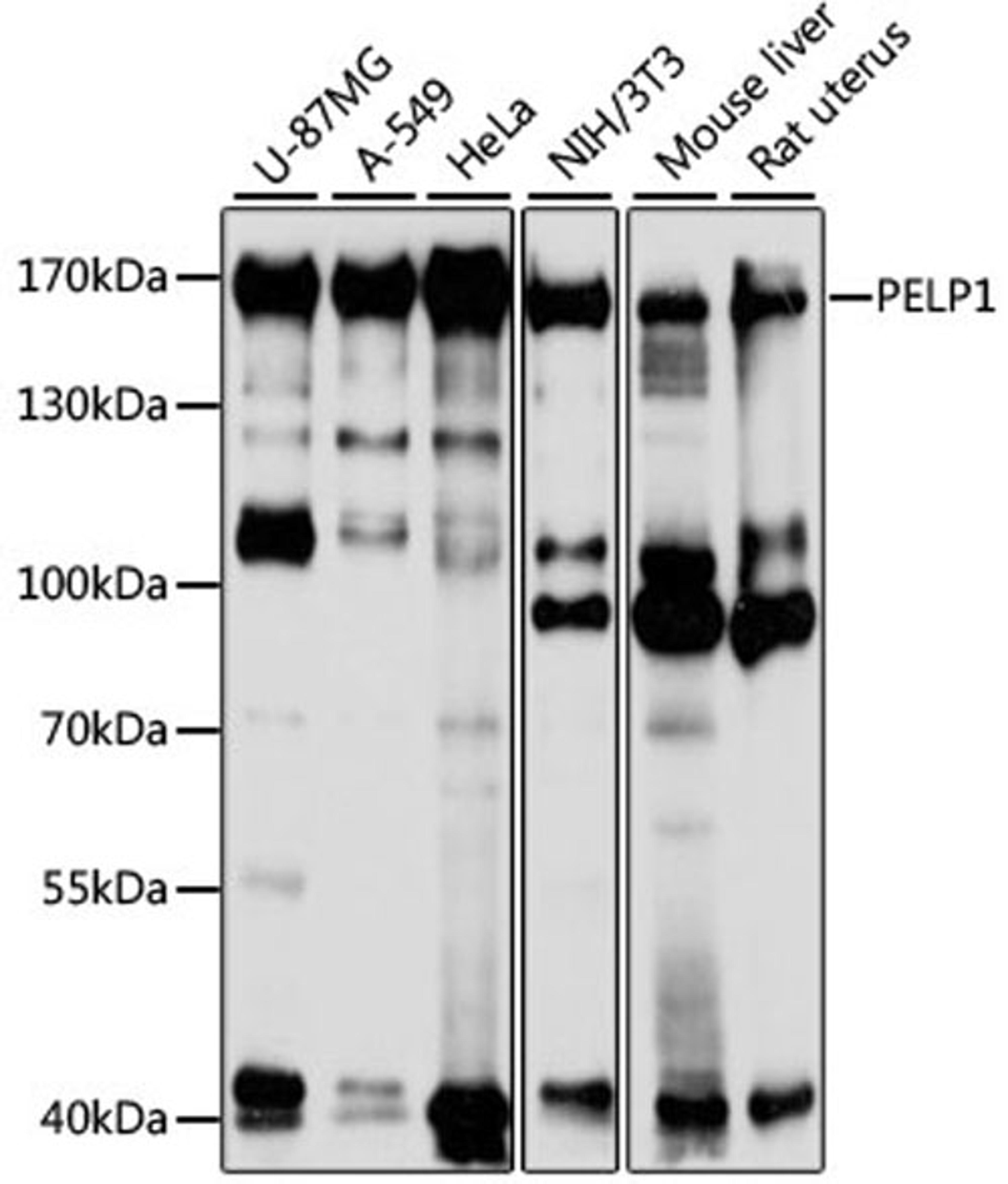 Western blot - PELP1 antibody (A3189)