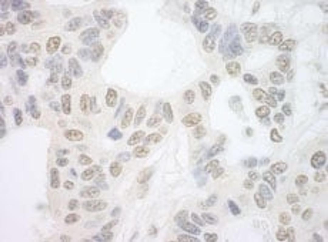 Detection of human PRP6 by immunohistochemistry.