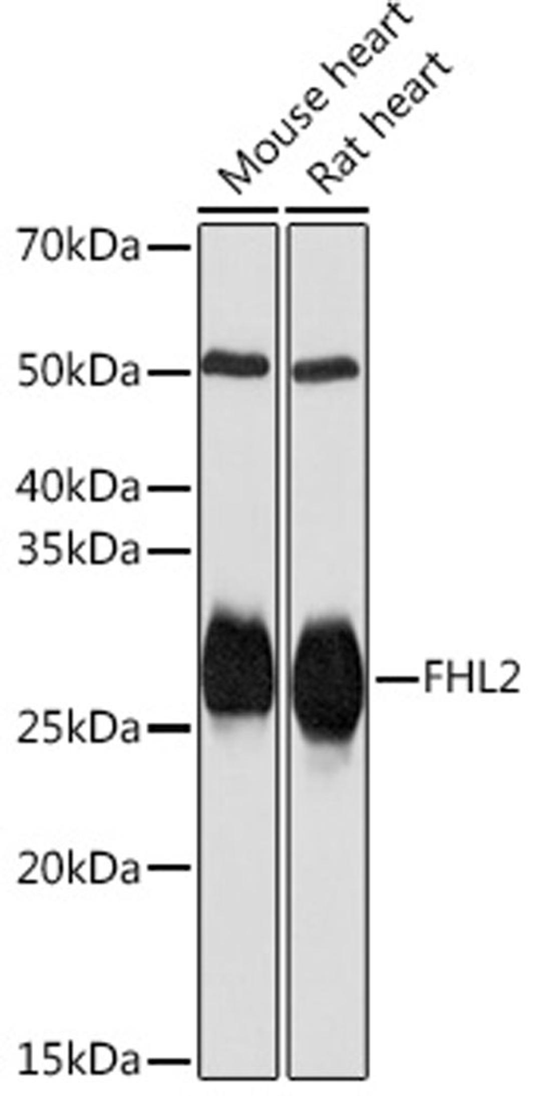 Western blot - FHL2 Rabbit mAb (A3670)