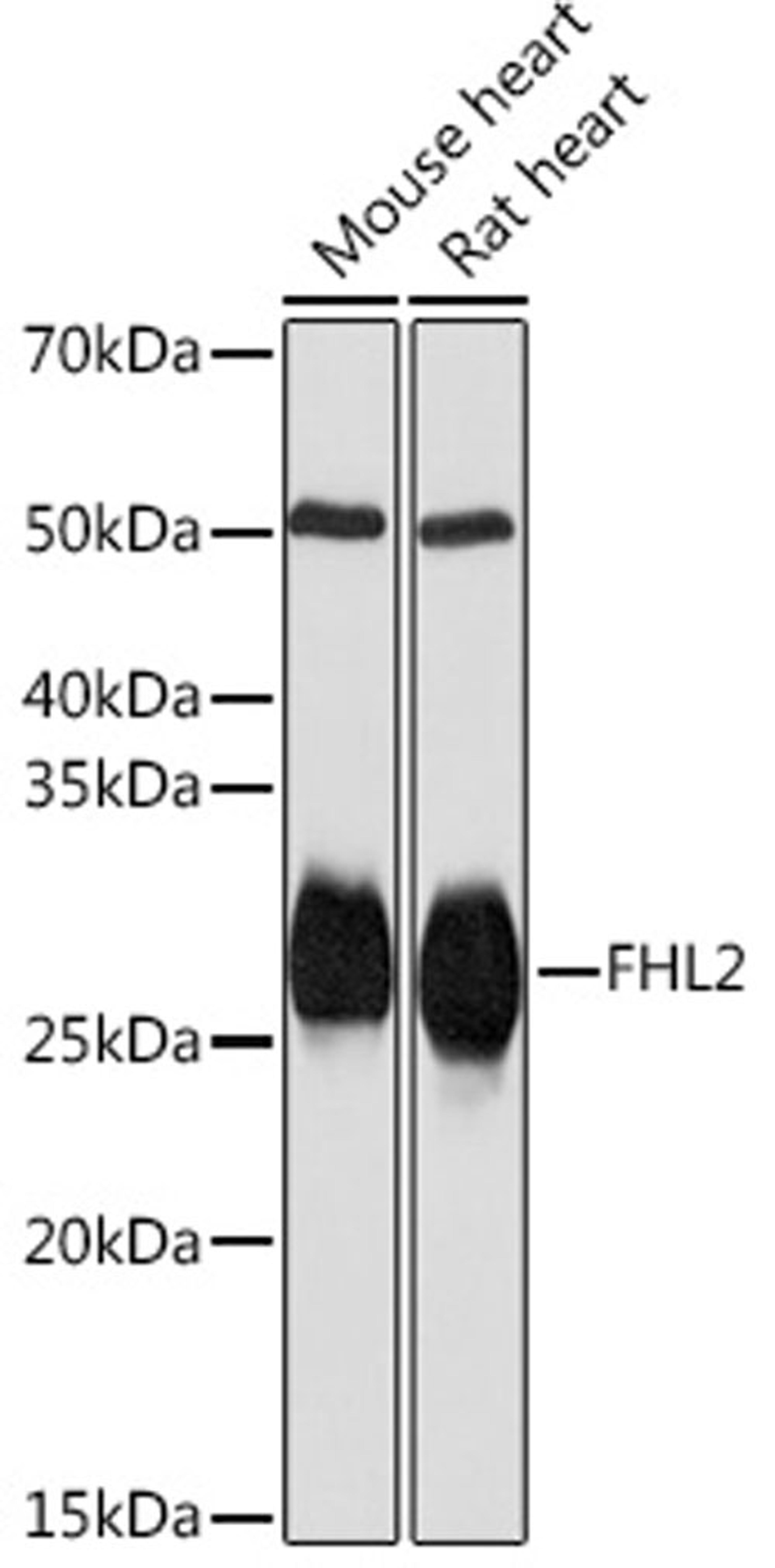 Western blot - FHL2 Rabbit mAb (A3670)