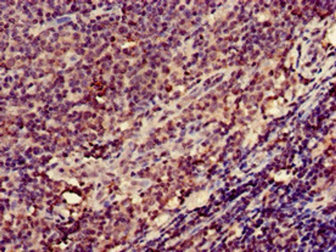 Immunohistochemistry of paraffin-embedded human lymph node tissue using CSB-PA011884LA01HU at dilution of 1:100