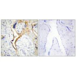 Immunohistochemistry analysis of paraffin-embedded human placenta tissue using CKI-ε antibody.