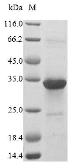(Tris-Glycine gel) Discontinuous SDS-PAGE (reduced) with 5% enrichment gel and 15% separation gel.
