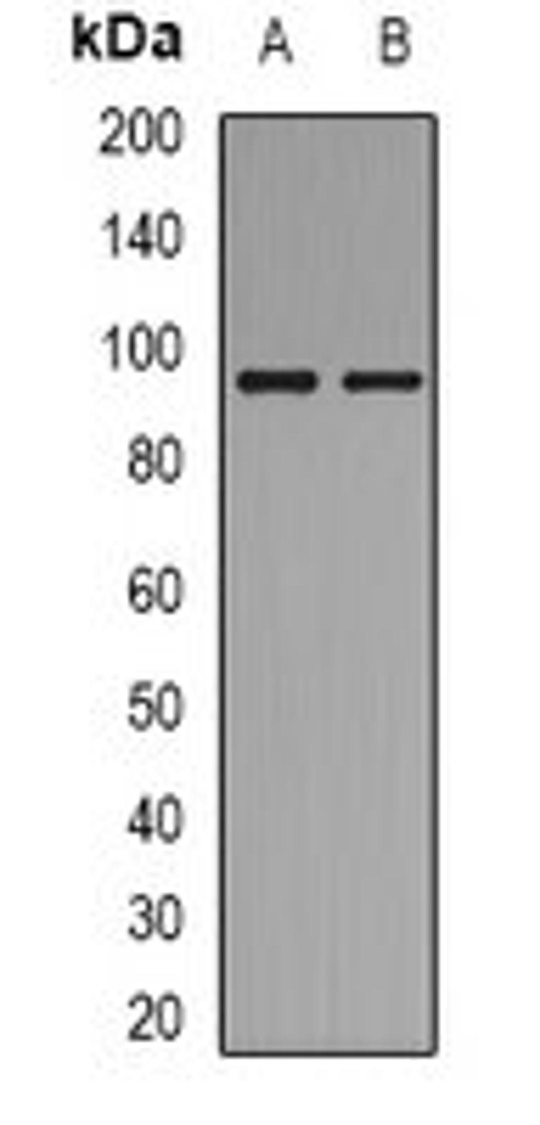 Western blot analysis of HuvEc (Lane 1), Jurkat (Lane 2) whole cell lysates using BCAR3 antibody