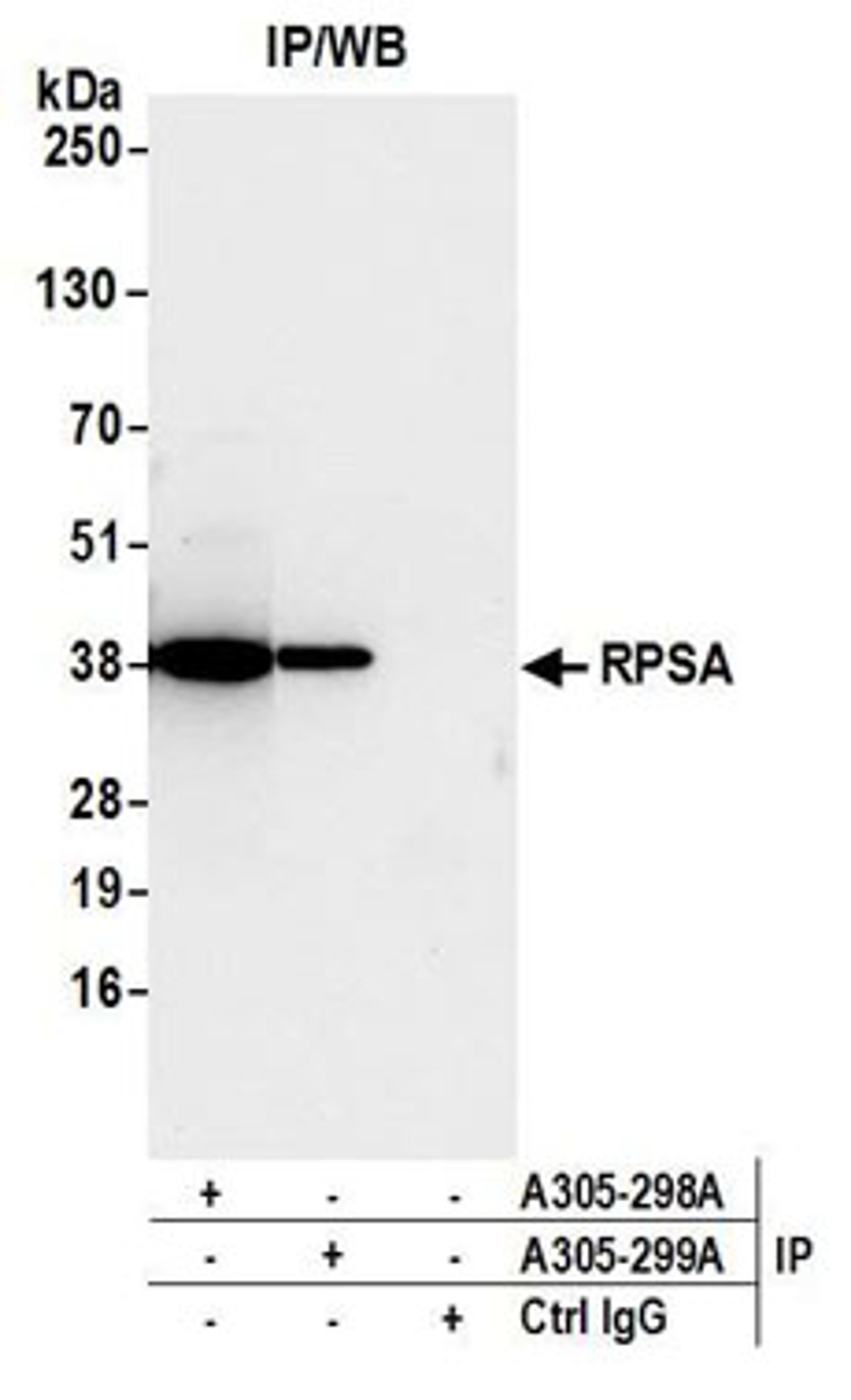 Detection of human RPSA by western blot of immunoprecipitates.