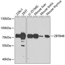 Western blot - ZBTB48 antibody (A7435)