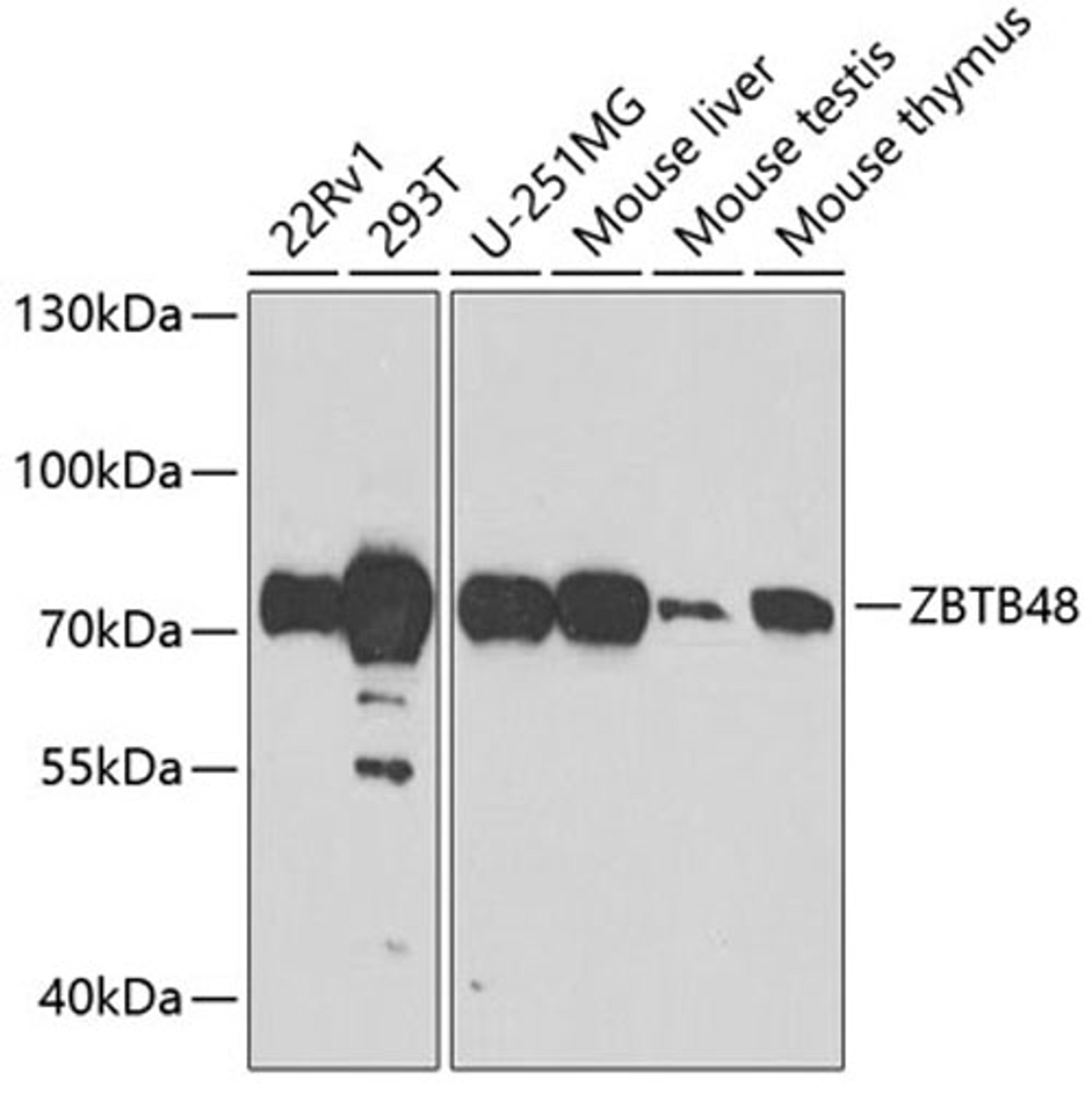 Western blot - ZBTB48 antibody (A7435)