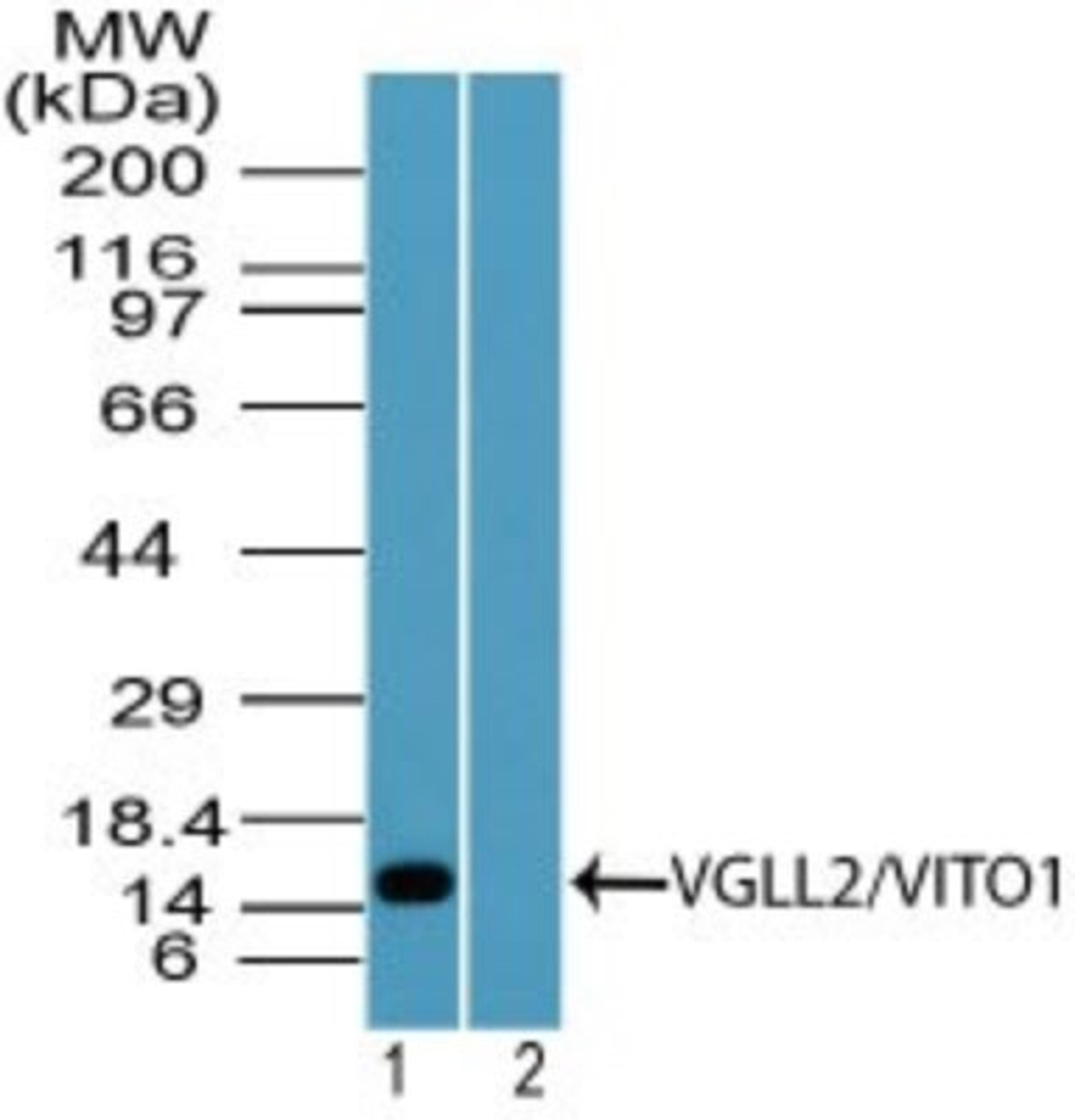 Western Blot: VGLL2 Antibody [NBP2-24649] - analysis of VGLL2/VITO1 in human skeletal muscle lysate in the 1) absence and 2) presence of immunizing peptide using this antibody. I goat anti-rabbit Ig HRP secondary antibody and PicoTect ECL substrate solution were used for this test.