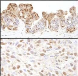 Detection of human and mouse VCP by immunohistochemistry.