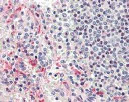 Immunohistochemistry staining of Heparanase in spleen tissue using Heparanase Antibody.