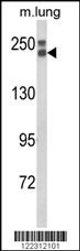 Western blot analysis of COL18A1 Antibody in mouse lung tissue lysates (35ug/lane)