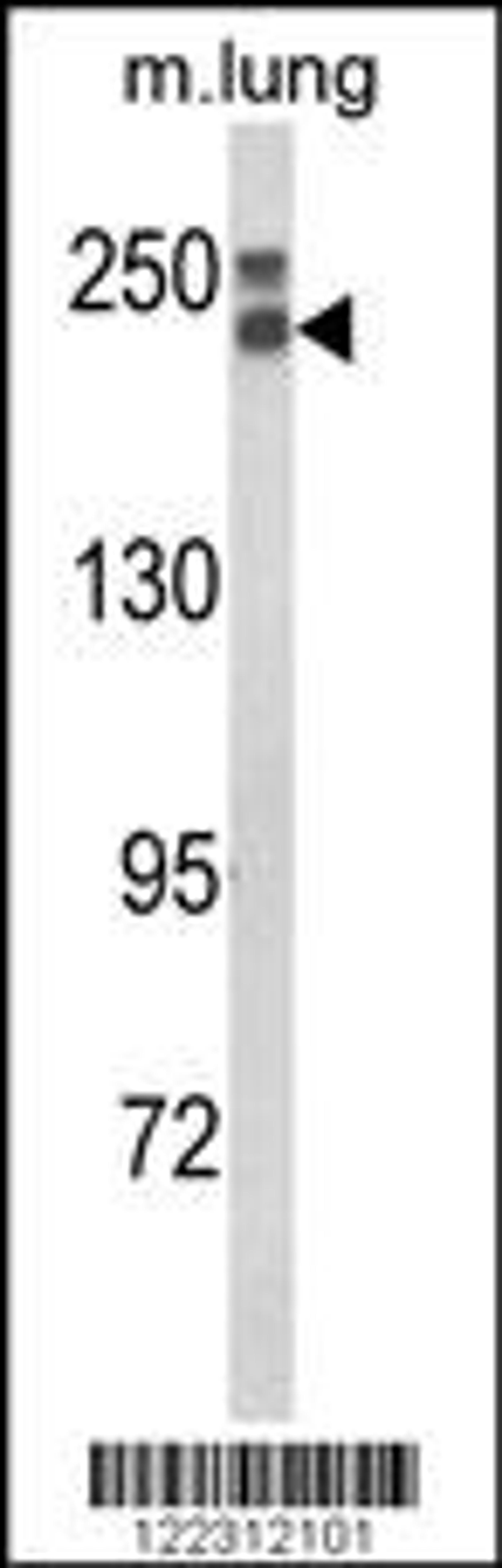 Western blot analysis of COL18A1 Antibody in mouse lung tissue lysates (35ug/lane)