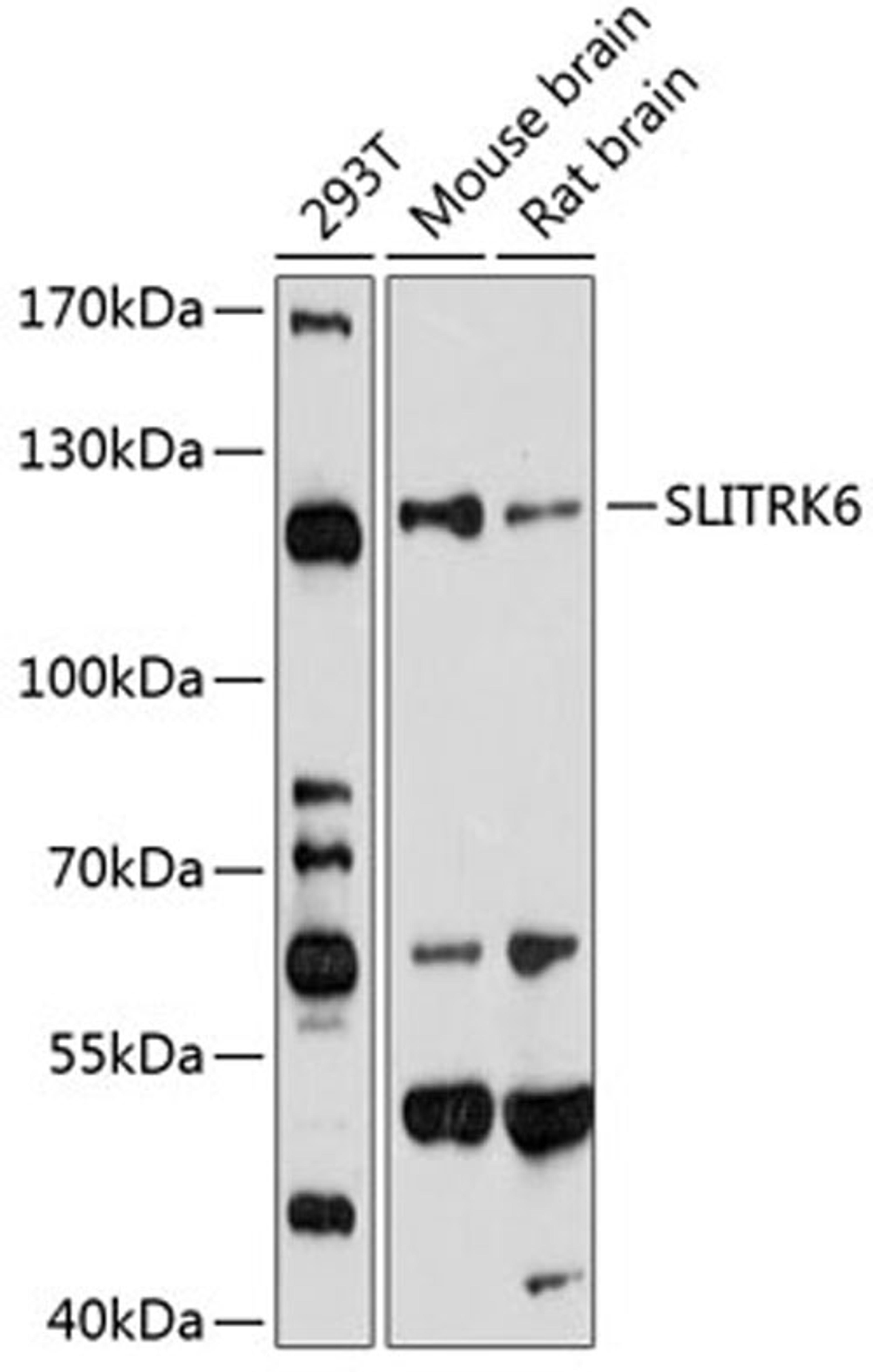 Western blot - SLITRK6 antibody (A3521)
