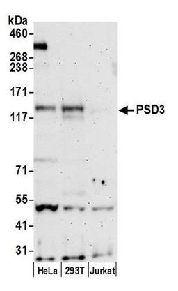 Detection of human PSD3 by WB.