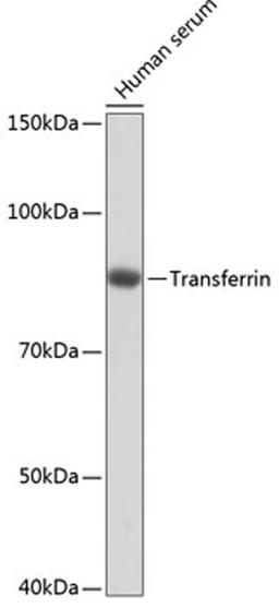 Western blot - Transferrin antibody (A19130)