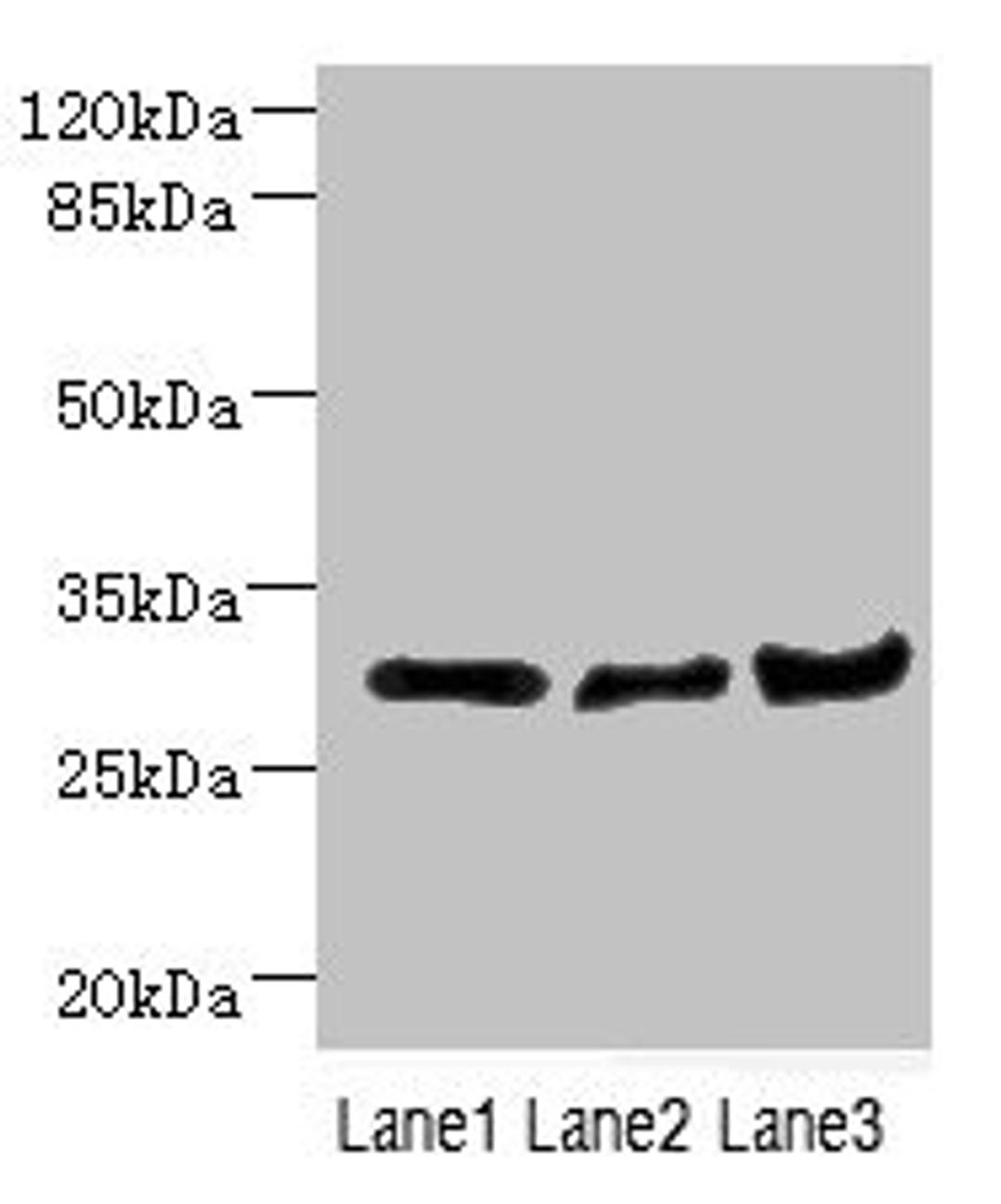 Western blot. All lanes: DCXR antibody at 2.23ug/ml. Lane 1: Mouse lung tissue. Lane 2: Mouse liver tissue. Lane 3: Mouse gonadal tissue. Secondary. Goat polyclonal to rabbit IgG at 1/10000 dilution. Predicted band size: 26 kDa. Observed band size: 26 kDa. 