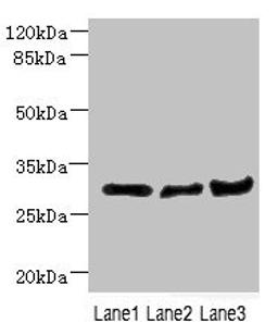 Western blot. All lanes: DCXR antibody at 2.23ug/ml. Lane 1: Mouse lung tissue. Lane 2: Mouse liver tissue. Lane 3: Mouse gonadal tissue. Secondary. Goat polyclonal to rabbit IgG at 1/10000 dilution. Predicted band size: 26 kDa. Observed band size: 26 kDa. 