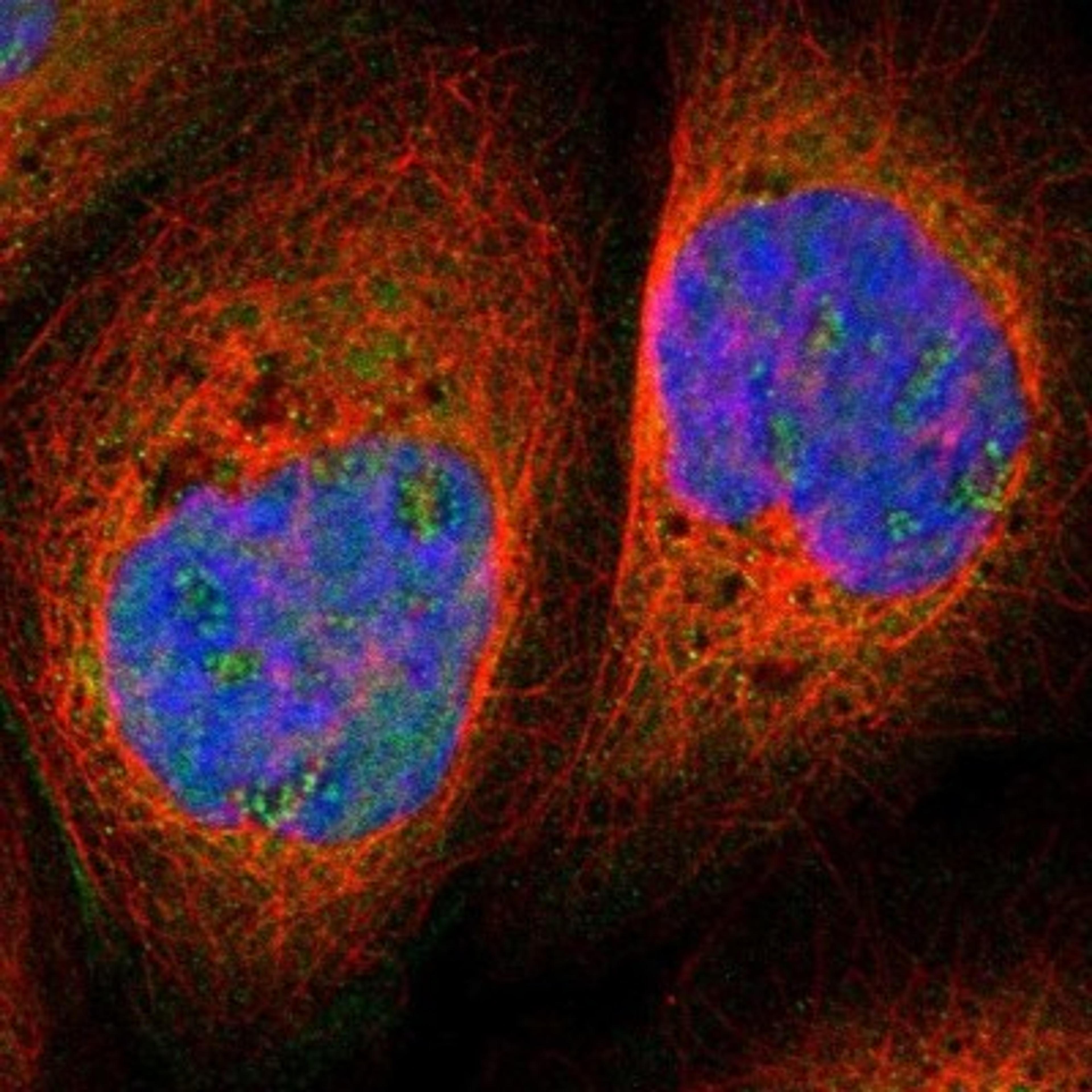 Immunocytochemistry/Immunofluorescence: PCP4 Antibody [NBP1-80929] - Staining of human cell line A-431 shows positivity in nucleus, nucleoli & cytoplasm.