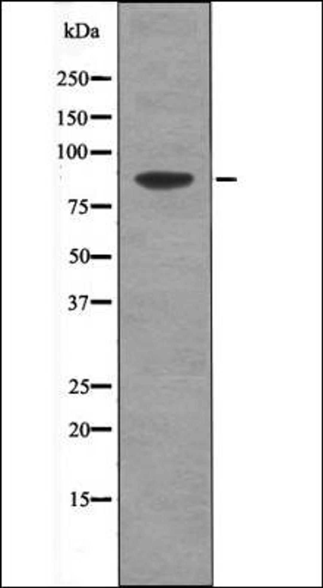 Western blot analysis of HepG2 whole cell lysates using TLK1 -Phospho-Ser764- antibody