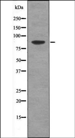 Western blot analysis of HepG2 whole cell lysates using TLK1 -Phospho-Ser764- antibody