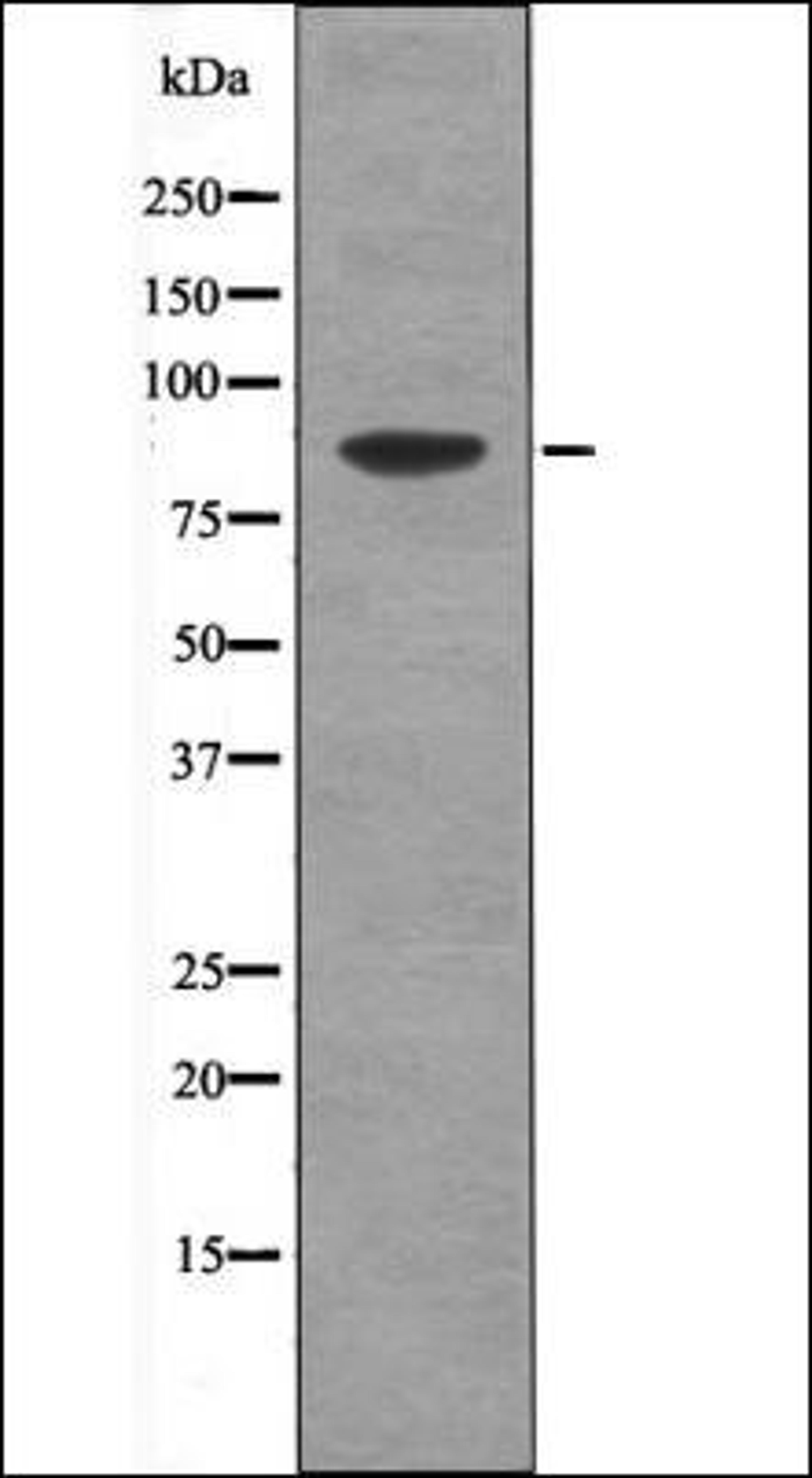 Western blot analysis of HepG2 whole cell lysates using TLK1 -Phospho-Ser764- antibody