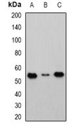 Western blot analysis of HEK293T (Lane1), Raji (Lane2), mouse kidney (Lane3) whole cell lysates using CBLC antibody