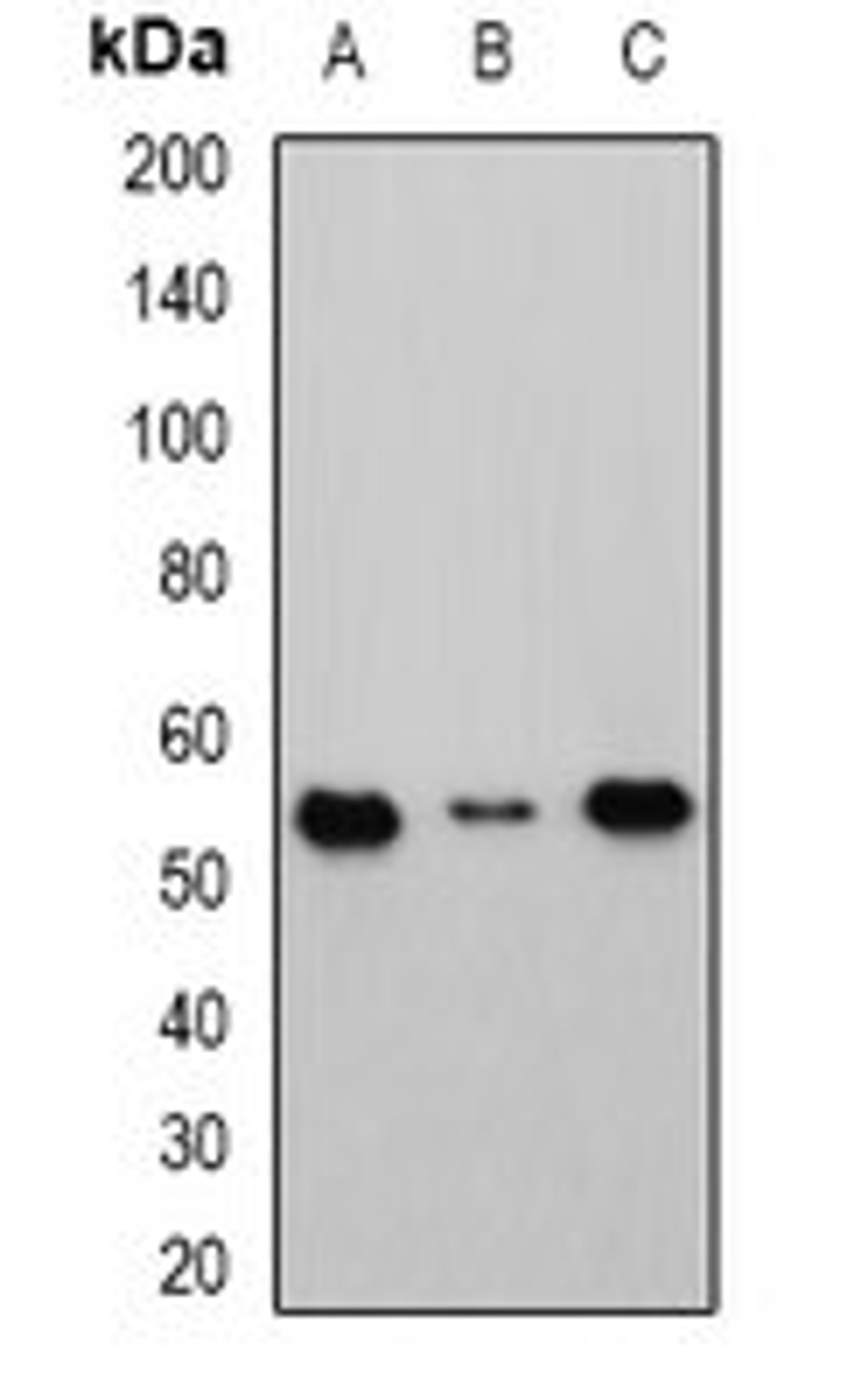 Western blot analysis of HEK293T (Lane1), Raji (Lane2), mouse kidney (Lane3) whole cell lysates using CBLC antibody