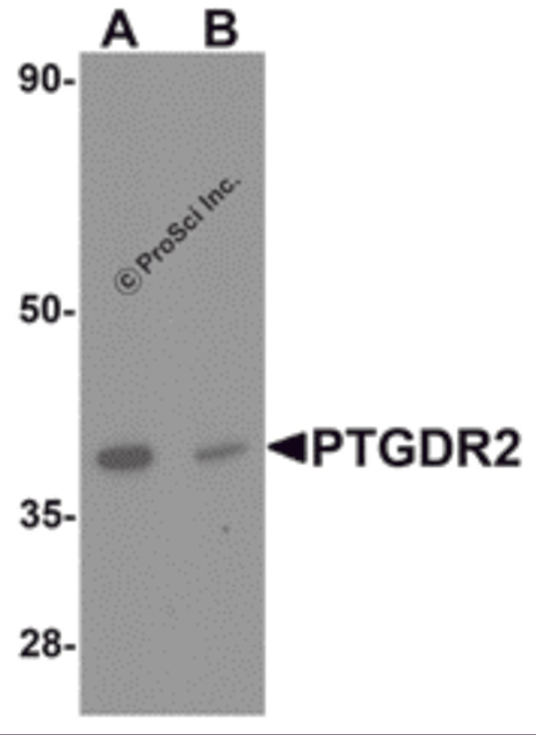 Western blot analysis of PTGDR2 in small intestine tissue lysate with PTGDR2 antibody at 1 μg/mL in (A) the absence and (B) the presence of blocking peptide.