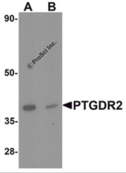 Western blot analysis of PTGDR2 in small intestine tissue lysate with PTGDR2 antibody at 1 μg/mL in (A) the absence and (B) the presence of blocking peptide.