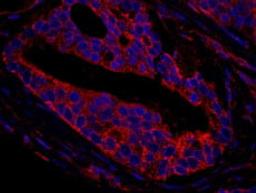 Detection of human CNOT3 by immunohistochemistry.