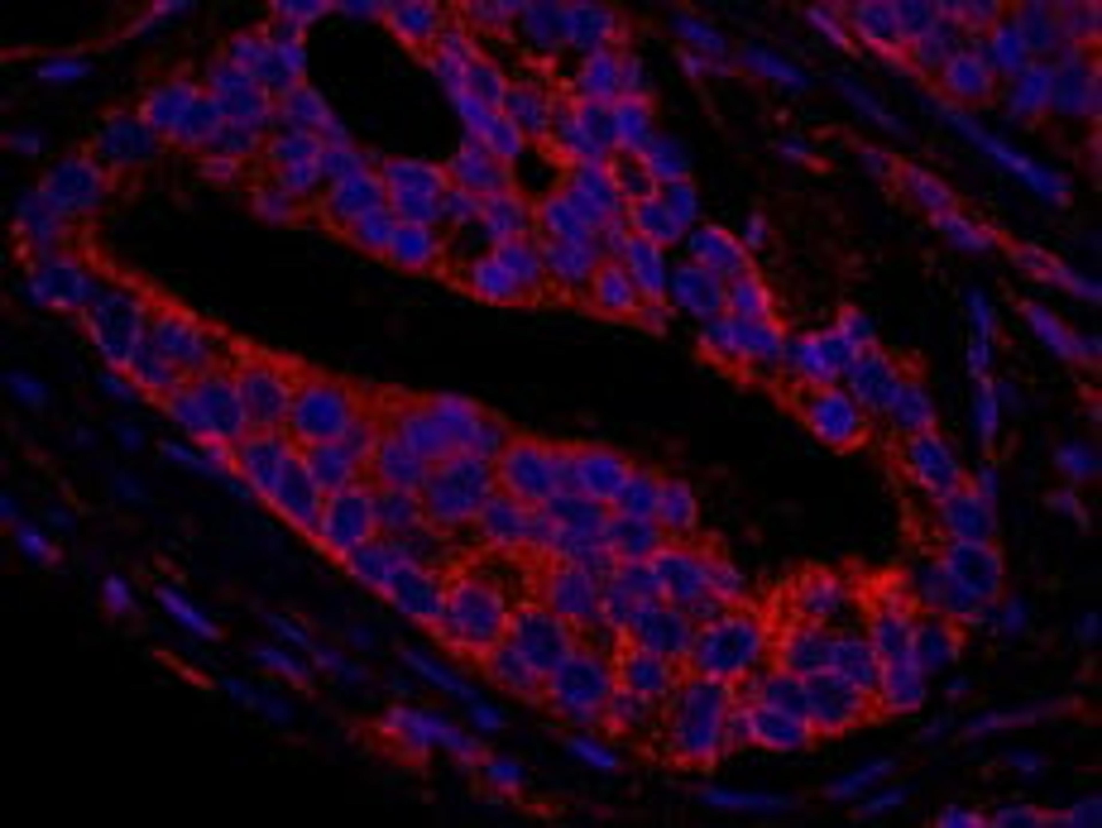 Detection of human CNOT3 by immunohistochemistry.