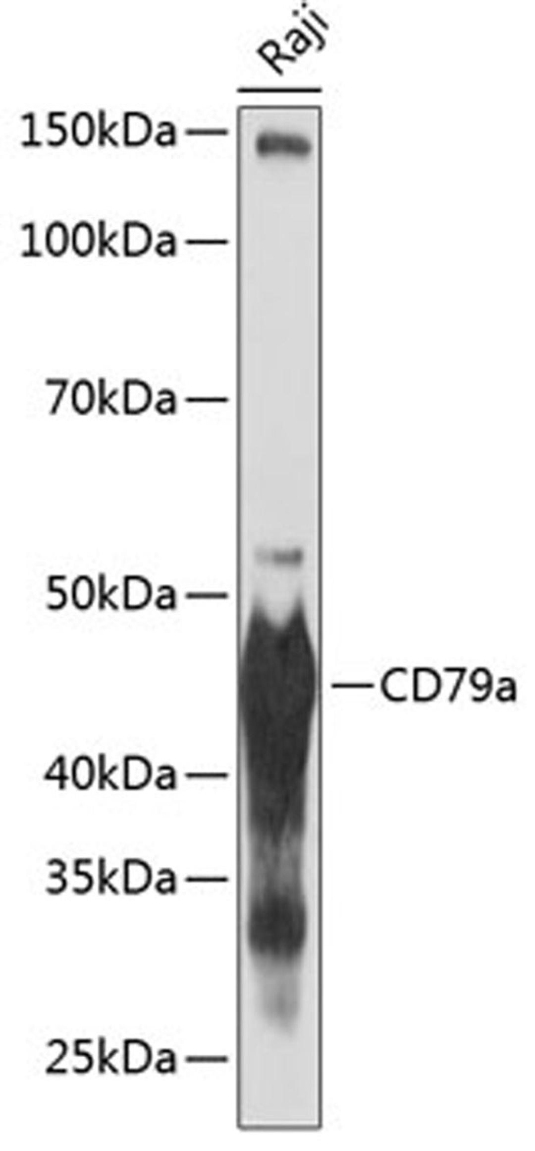 Western blot - CD79a antibody (A19024)