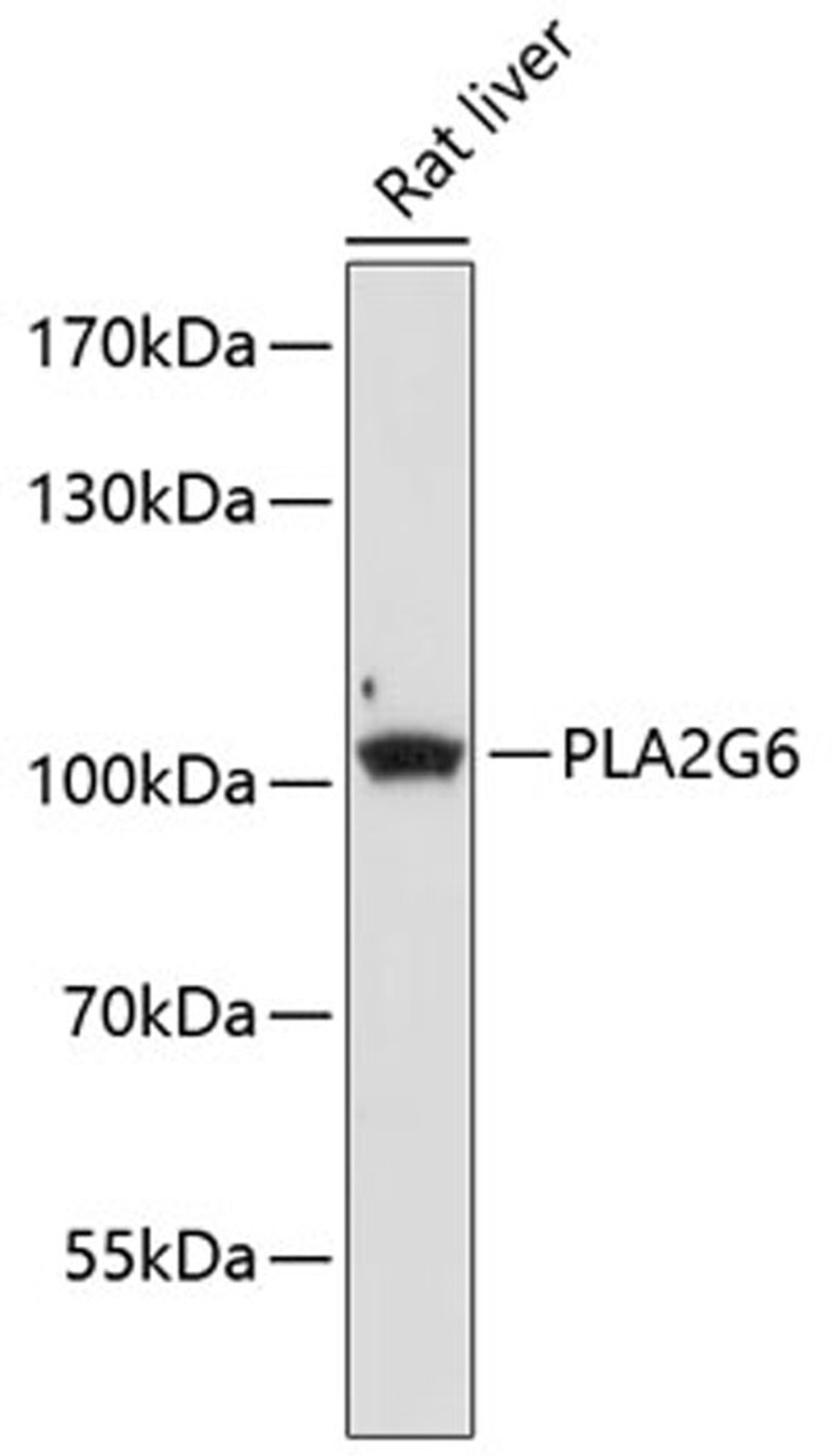 Western blot - PLA2G6 antibody (A9492)