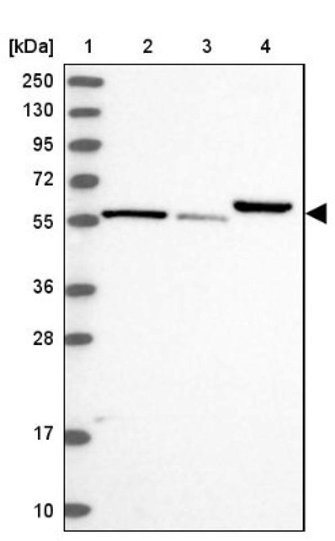 Western Blot: IP6K1 Antibody [NBP1-92026] - Lane 1: Marker [kDa] 250, 130, 95, 72, 55, 36, 28, 17, 10<br/>Lane 2: Human cell line RT-4<br/>Lane 3: Human cell line U-251MG sp<br/>Lane 4: Human plasma (IgG/HSA depleted)