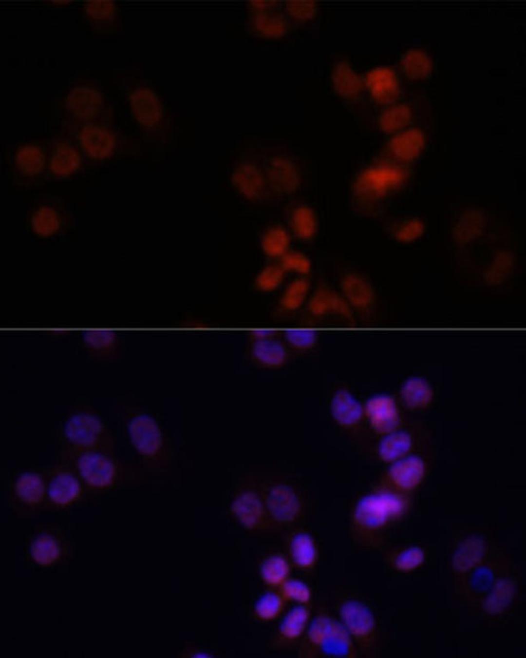 Immunofluorescence - KDM7A antibody (A14692)