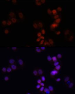 Immunofluorescence - KDM7A antibody (A14692)