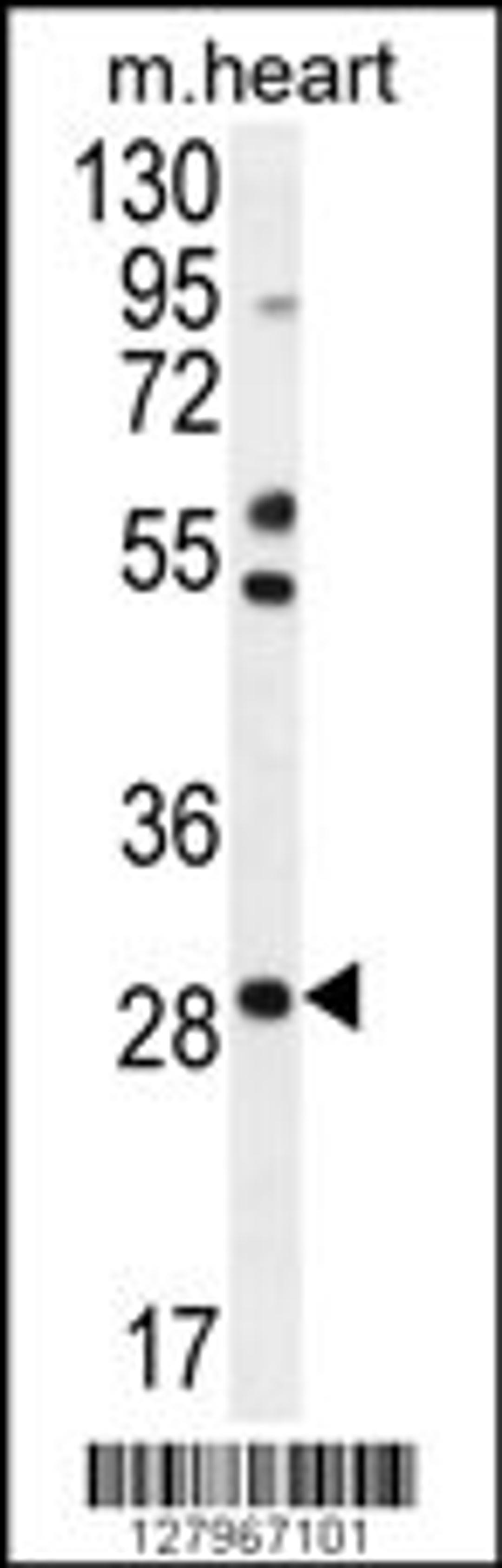 Western blot analysis in mouse heart tissue lysates (35ug/lane).