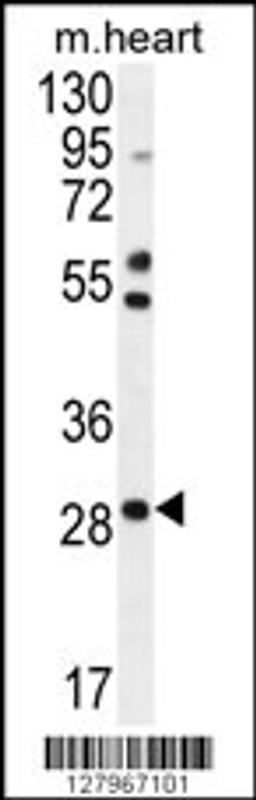 Western blot analysis in mouse heart tissue lysates (35ug/lane).