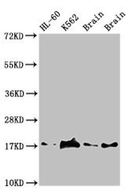 Western Blot. Positive WB detected in: HL60 whole cell lysate, K562 whole cell lyaste, Mouse brain tissue, Rat brain tissue. All lanes: UBE2V2 antibody at 1.5µg/ml. Secondary. Goat polyclonal to rabbit IgG at 1/50000 dilution. Predicted band size: 17 kDa. Observed band size: 17 kDa