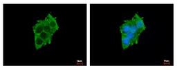 Immunocytochemistry/Immunofluorescence: SLC17A5 Antibody [NBP2-20383] - Sample: HepG2 cells were fixed in -20C 100% MeOH for 5 min. Green: SLC17A5 protein stained by SLC17A5 antibody diluted at 1:500. Blue: Hoechst 33343 staining.